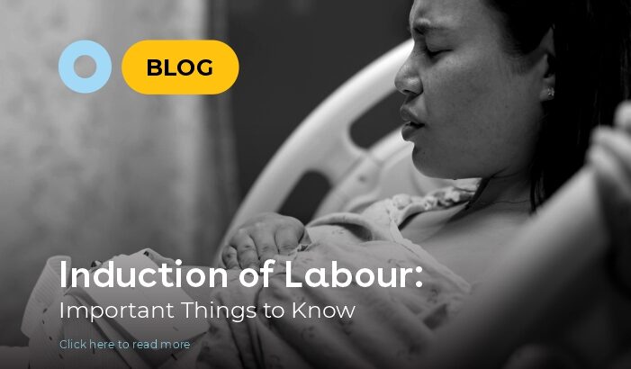 Labour Induction 2